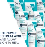 CeraVe Acne Foaming Cream Cleanser, 4% Benzoyl Peroxide Face Wash With Hyaluronic Acid - Image 2