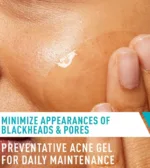CeraVe Acne Control Gel With AHA & BHA - Image 6