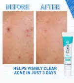 CeraVe Acne Control Gel With AHA & BHA - Image 8