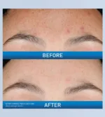 CeraVe Resurfacing Retinol Serum - Image 2
